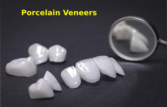 Porcelain Veneers